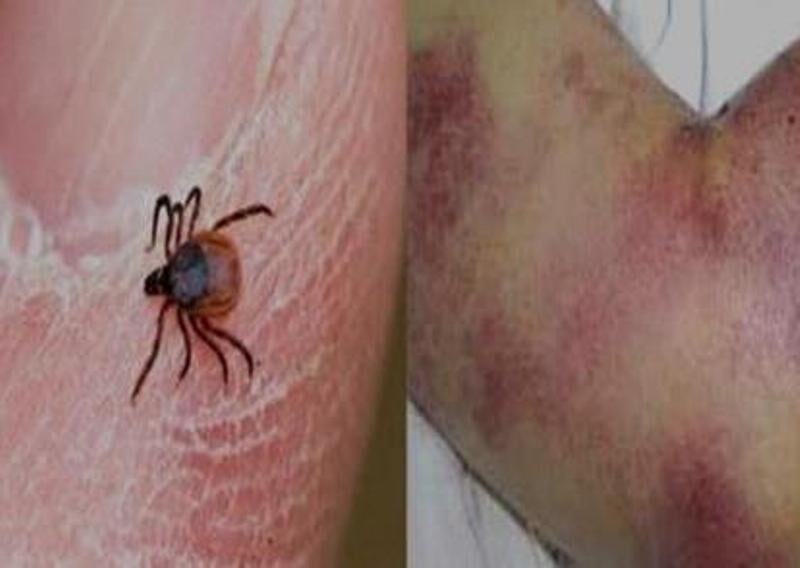 دامپزشکی استان تهران درباره شیوع تب کریمه کنگو در دامداری‌ها هشدار داد