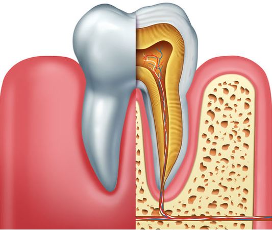                                 عصب کشی دندان