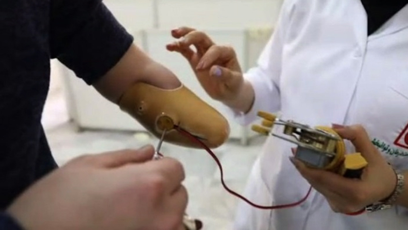 Frist Iran-made robotic hand prosthesis enters mass-production